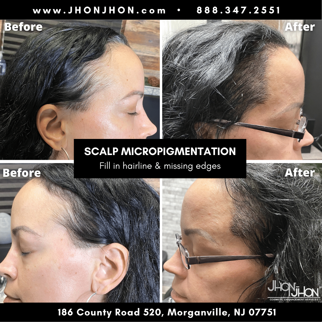 before after photos 8 orig