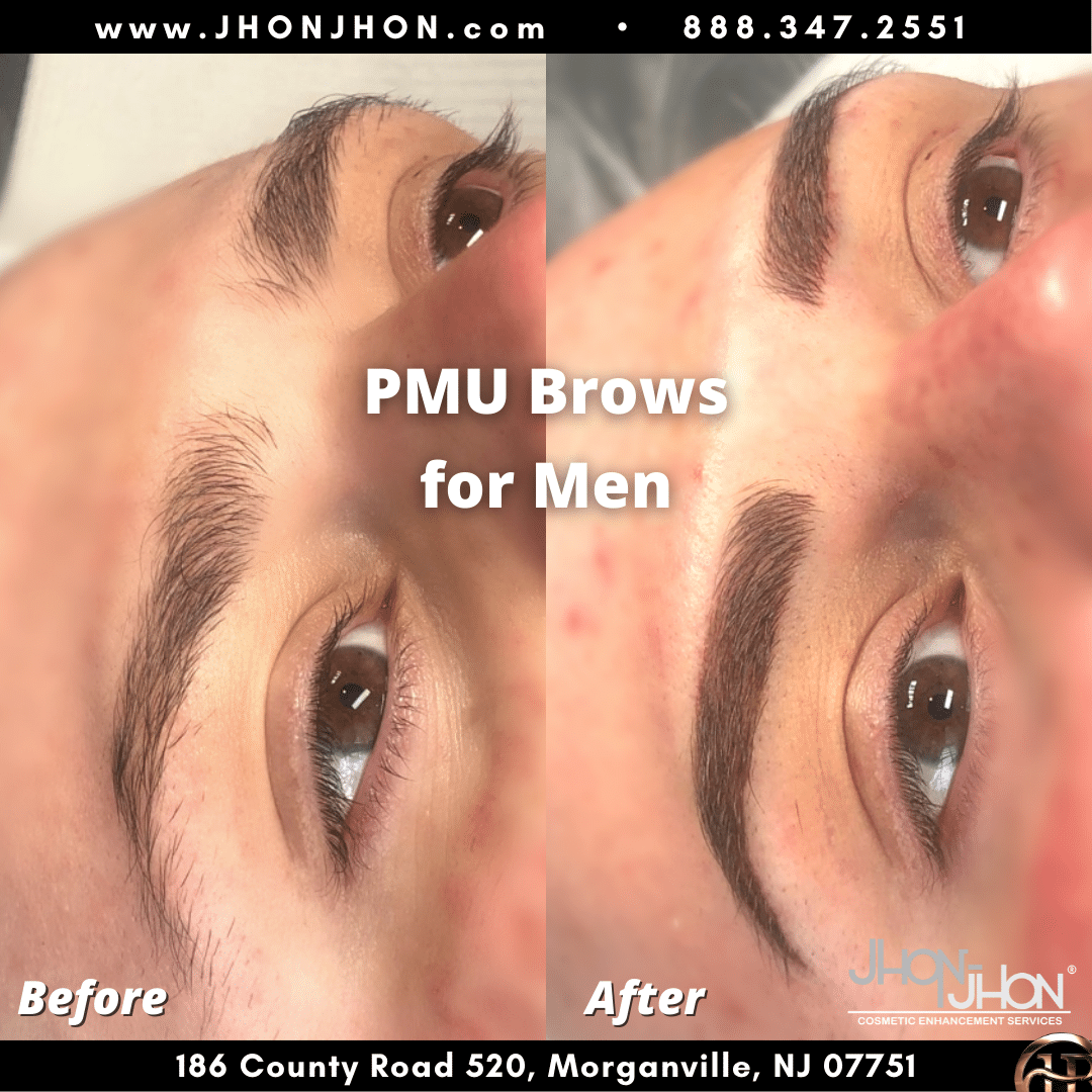 before after photos 9 1