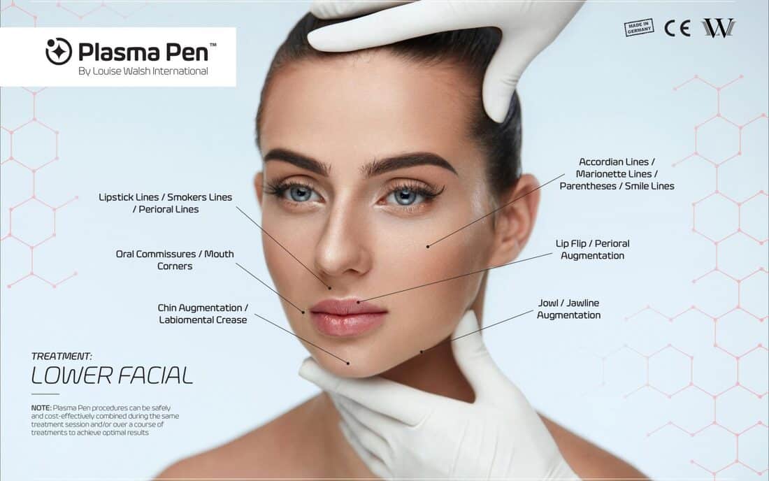 treatment guide lower facial 1600x1000 orig