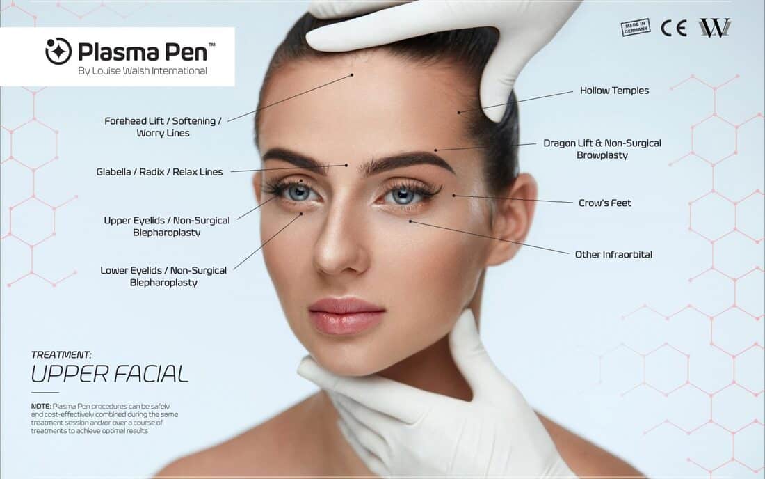 treatment guide upper facial 1600x1000 orig