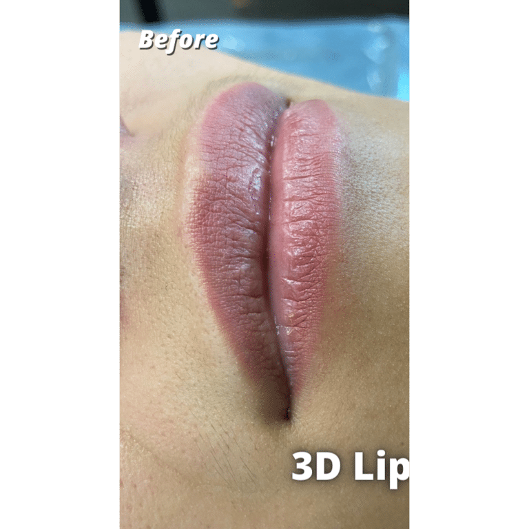 Before Image: 3D Lip Blush - front