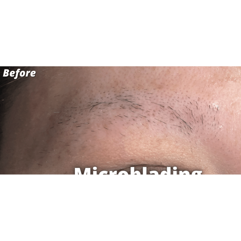 Before Image: Microblading - right-front-oblique