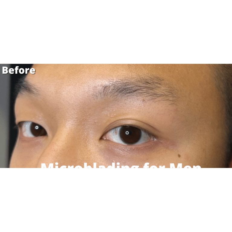 Before Image: Microblading - left-front-oblique